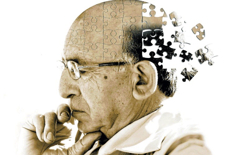 Alzheimer e imbetzamentu in Sardigna